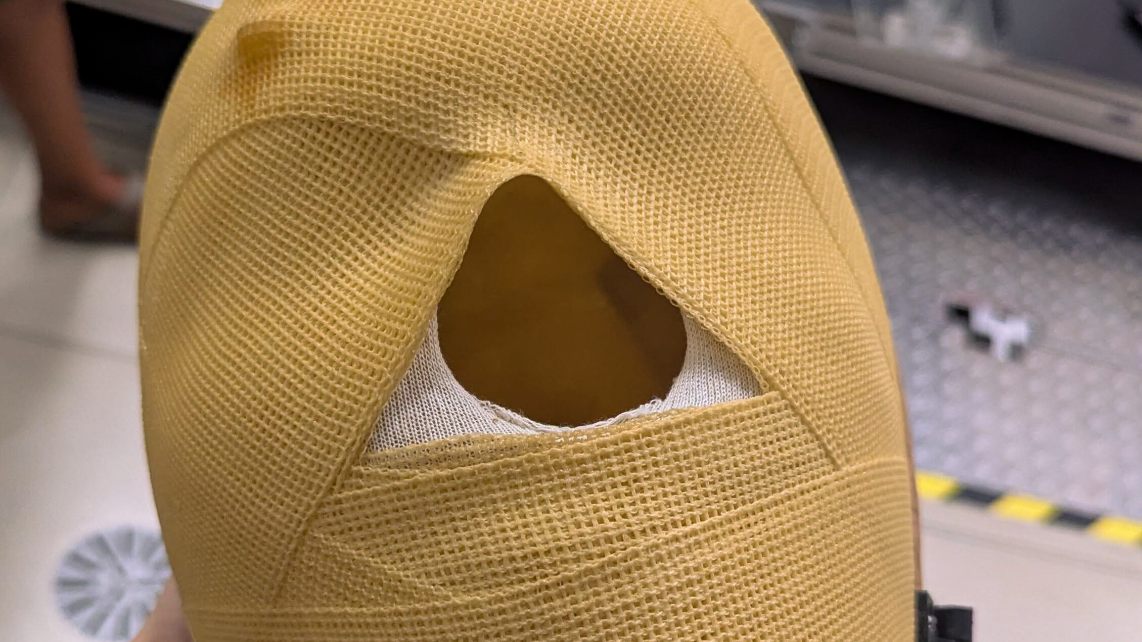 Maske zum Fixieren des Kopfes bei einer Tumortherapie